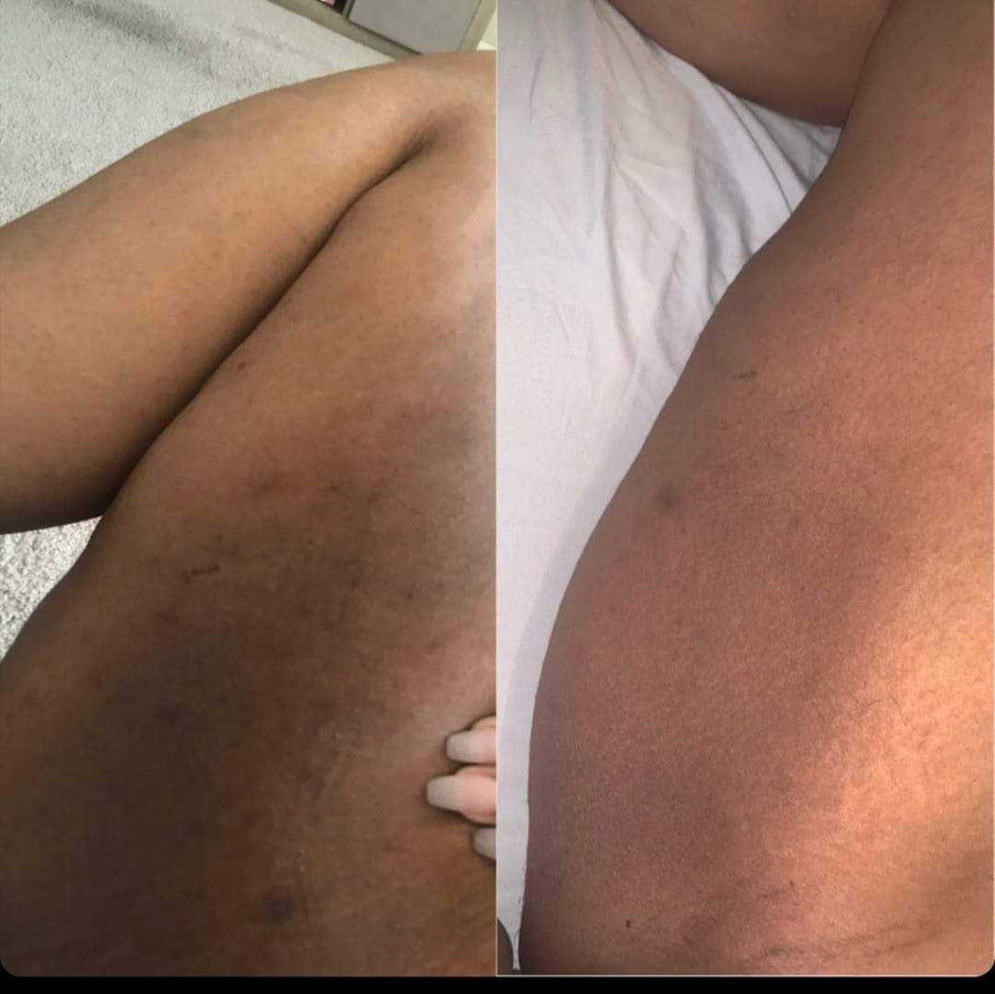 Inner Thigh Lightener (7 left)